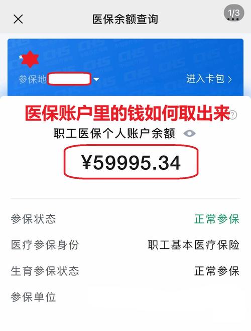 德馨医保在线提取新政策解读：你的医保余额真的能随时变现吗？